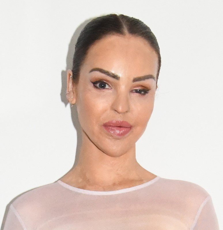 Katie Piper — Inspirational Broadcaster, Philanthropist and Best-Selling Author